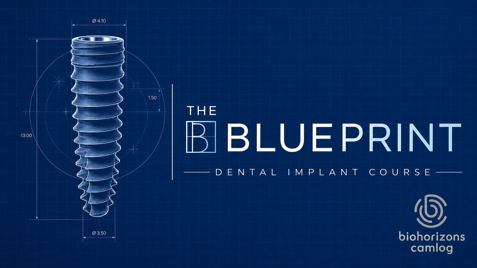 The Blueprint Implants