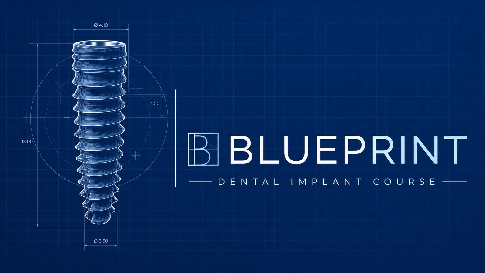 The Blueprint Implants